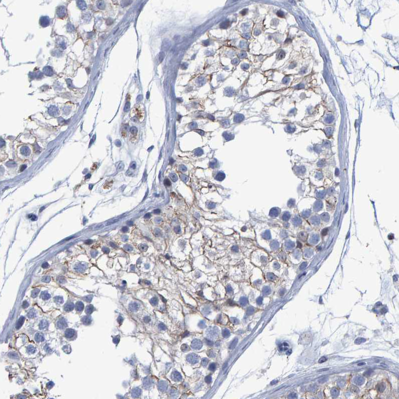 Atlas Antibodies Anti-PROCA1 Antibody