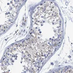 Atlas Antibodies Anti-PROCA1 Antibody
