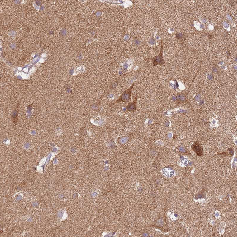 Atlas Antibodies Anti-PROKR2 Antibody