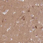 Atlas Antibodies Anti-PROKR2 Antibody