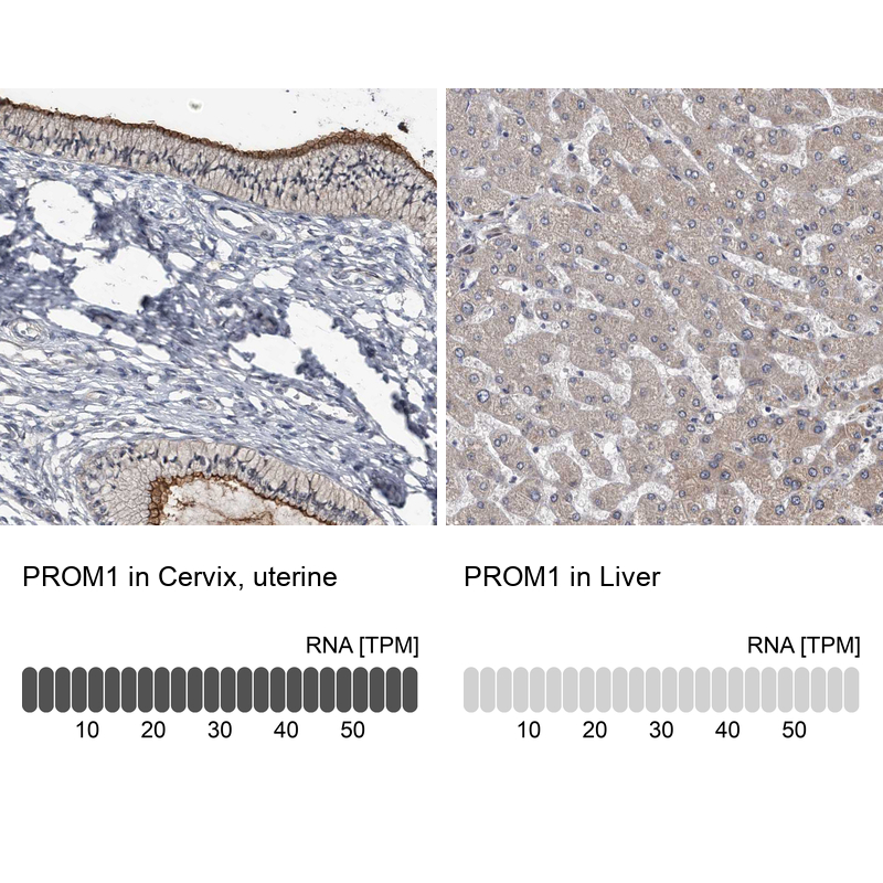 Atlas Antibodies Anti-PROM1 Antibody