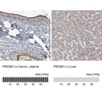 Atlas Antibodies Anti-PROM1 Antibody