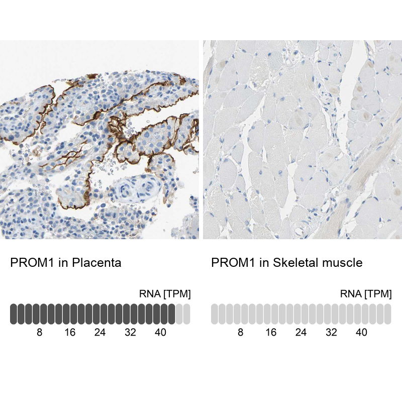Atlas Antibodies Anti-PROM1 Antibody