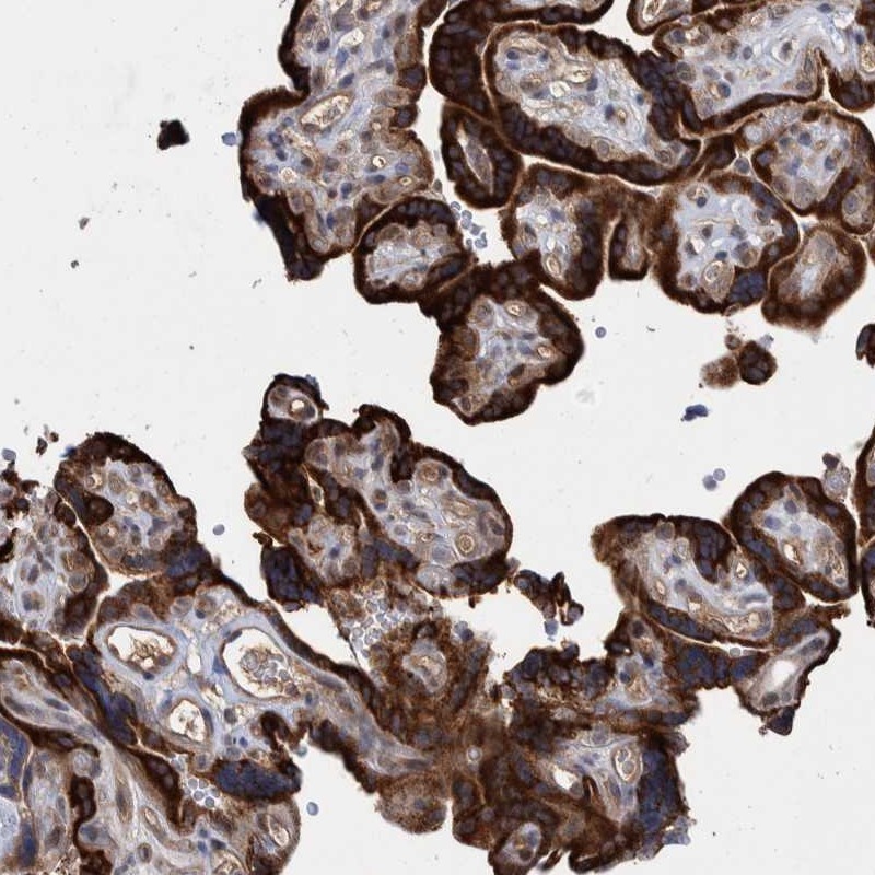 Atlas Antibodies Anti-PROSC Antibody