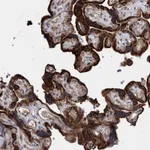 Atlas Antibodies Anti-PROSC Antibody
