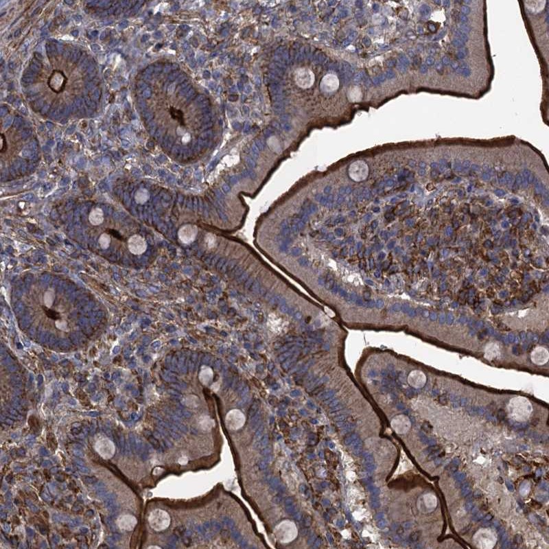 Atlas Antibodies Anti-PROSER2 Antibody