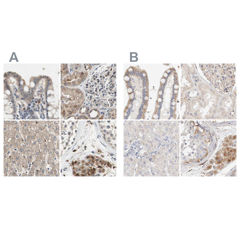 Atlas Antibodies Anti-PROS1 Antibody
