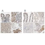 Atlas Antibodies Anti-PROS1 Antibody
