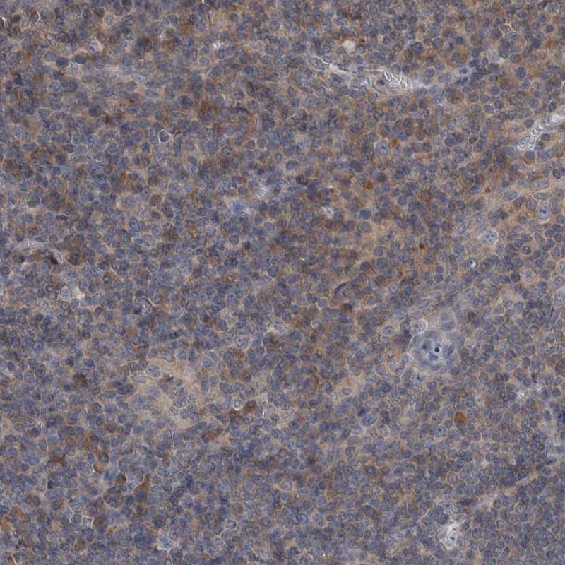 Atlas Antibodies Anti-PROSC Antibody