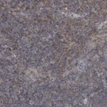 Atlas Antibodies Anti-PROSC Antibody