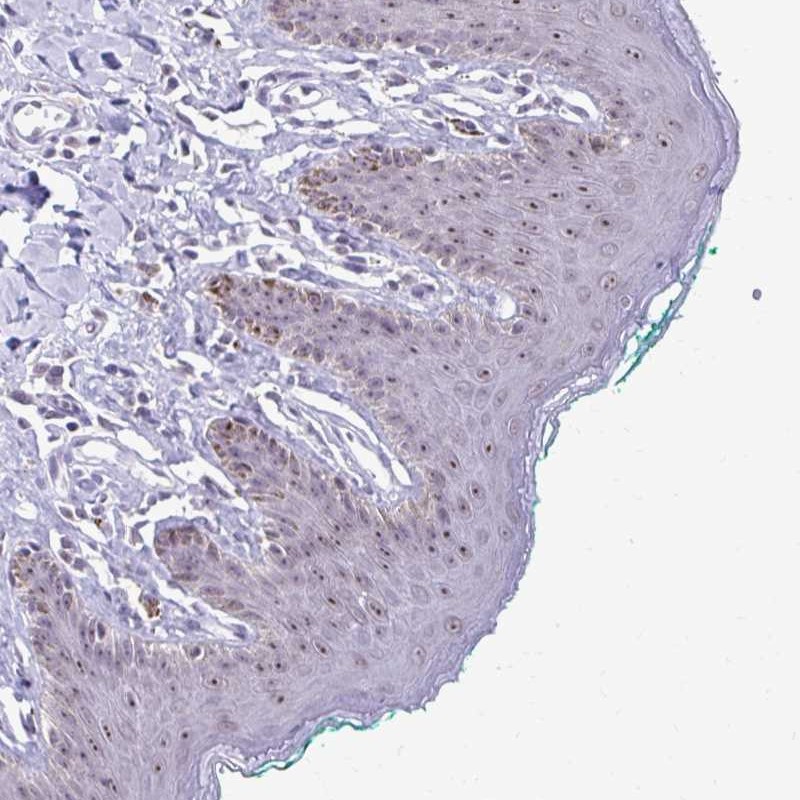 Atlas Antibodies Anti-PROSER1 Antibody