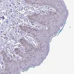 Atlas Antibodies Anti-PROSER1 Antibody