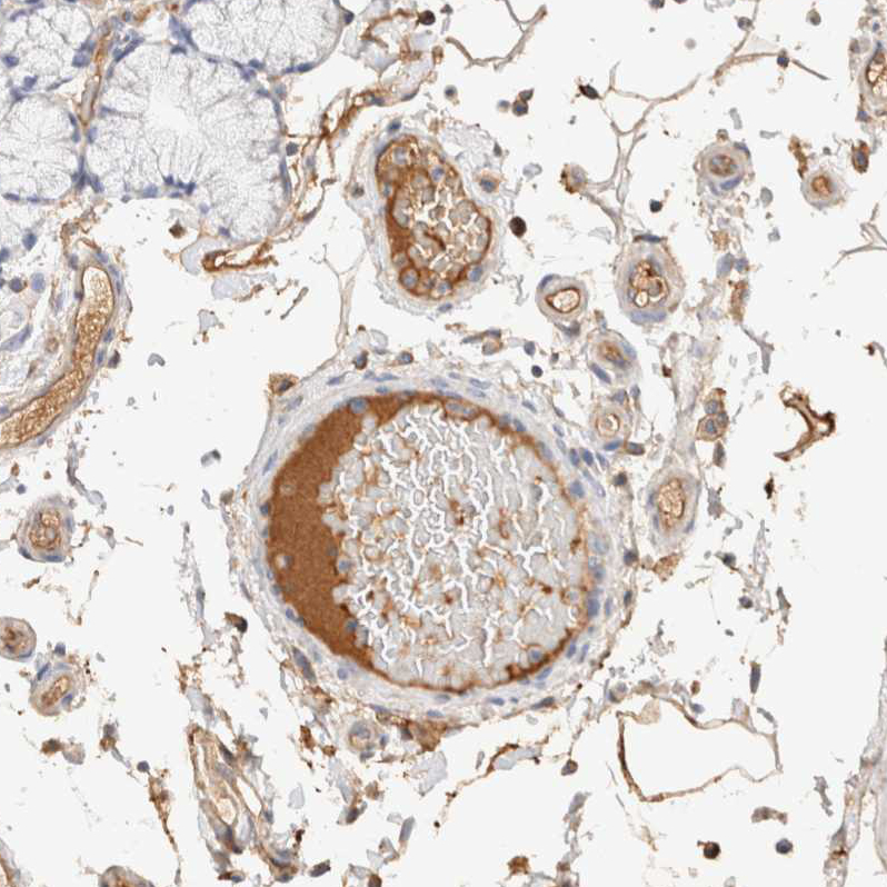 Atlas Antibodies Anti-PROS1 Antibody