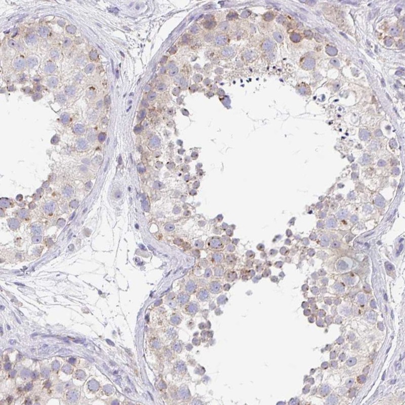 Atlas Antibodies Anti-PROSER3 Antibody