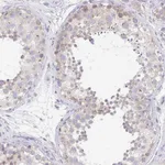 Atlas Antibodies Anti-PROSER3 Antibody
