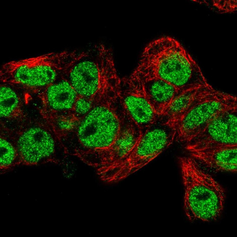 Atlas Antibodies Anti-PROX1 Antibody