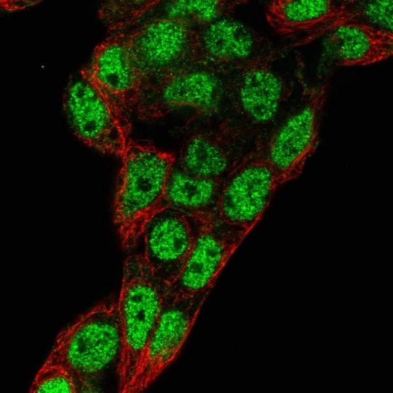 Atlas Antibodies Anti-PROX1 Antibody