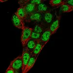 Atlas Antibodies Anti-PROX1 Antibody