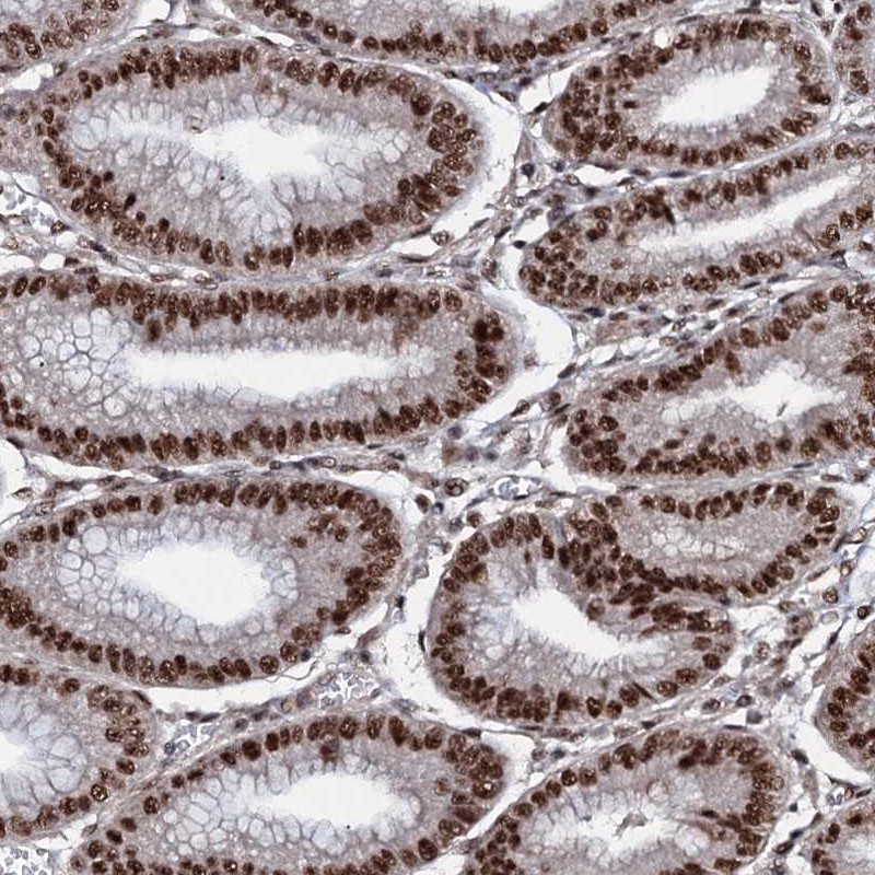 Atlas Antibodies Anti-PRPF18 Antibody