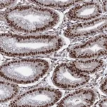 Atlas Antibodies Anti-PRPF18 Antibody