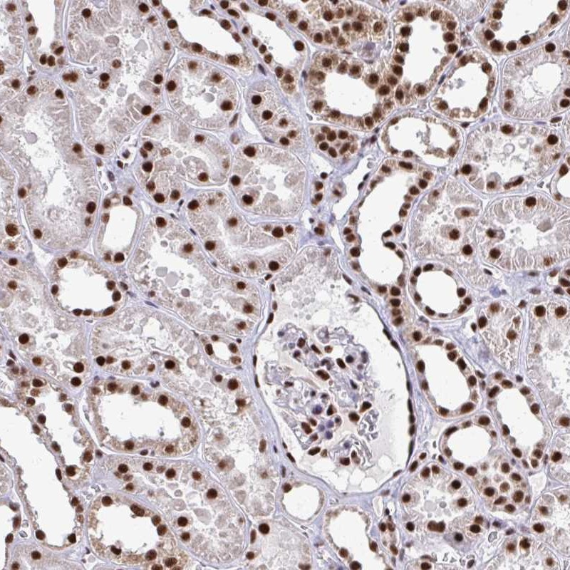 Atlas Antibodies Anti-PRPF19 Antibody