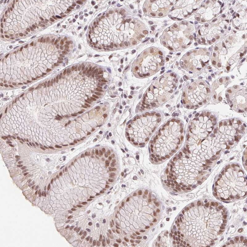 Atlas Antibodies Anti-PRPF18 Antibody