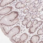 Atlas Antibodies Anti-PRPF18 Antibody
