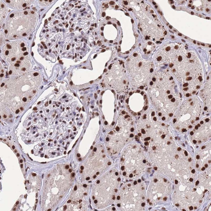 Atlas Antibodies Anti-PRPF19 Antibody