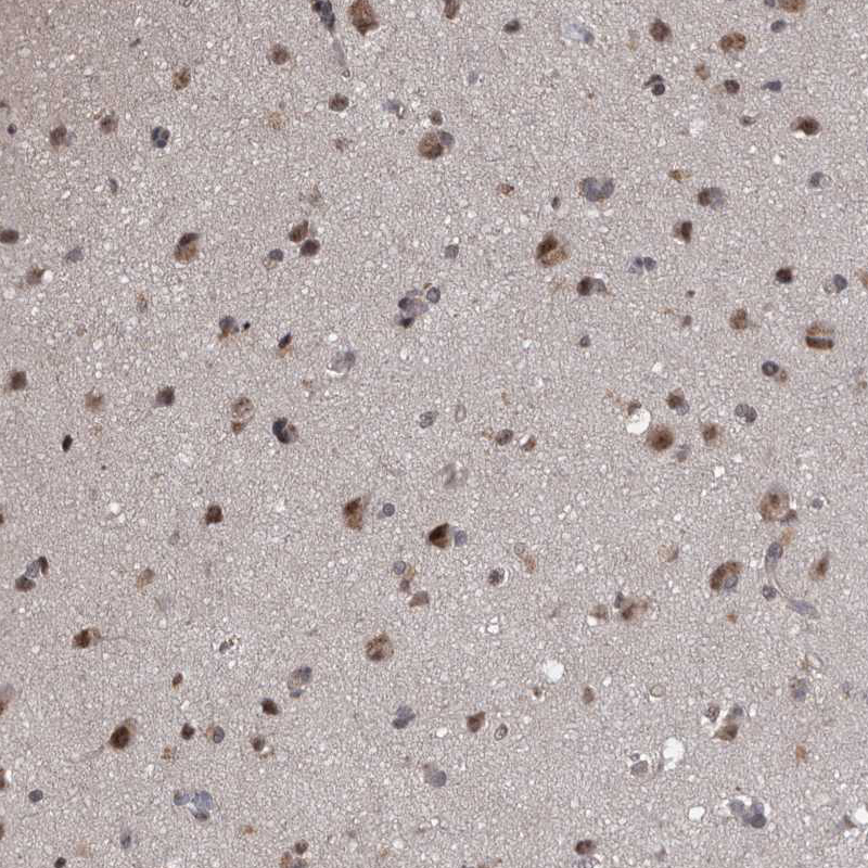 Atlas Antibodies Anti-PRPF3 Antibody