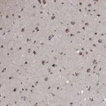 Atlas Antibodies Anti-PRPF3 Antibody