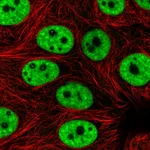 Atlas Antibodies Anti-PRPF3 Antibody