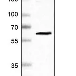 Atlas Antibodies Anti-PRPF31 Antibody