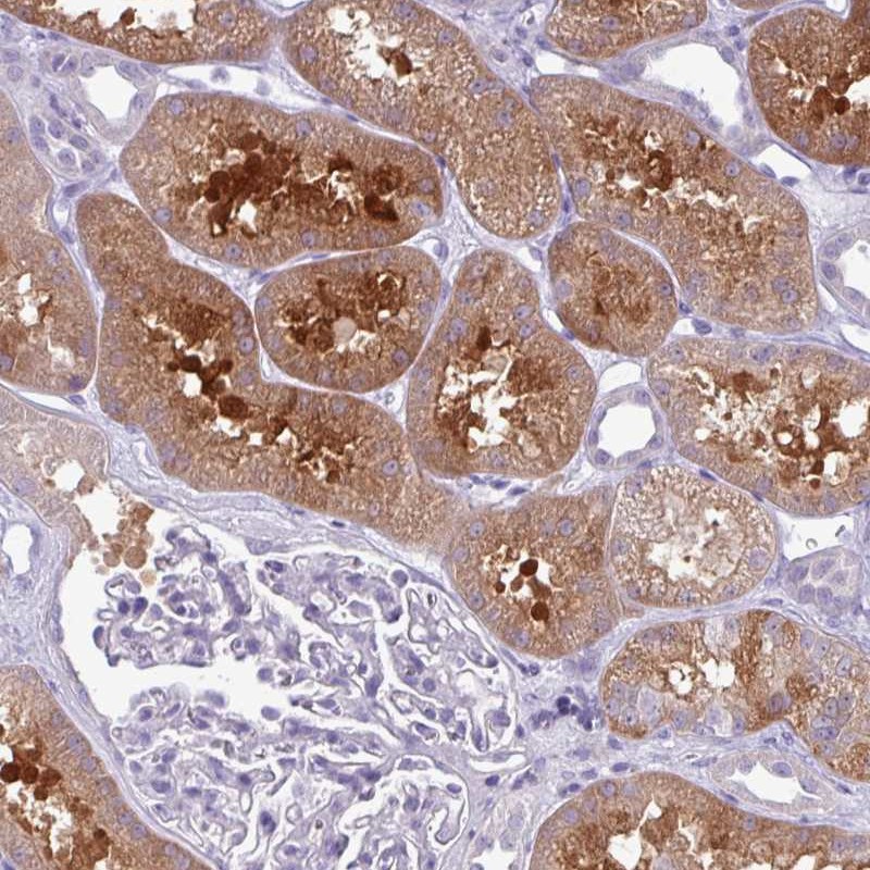 Atlas Antibodies Anti-PRPF38A Antibody