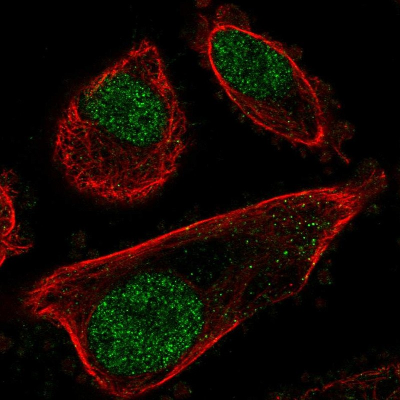 Atlas Antibodies Anti-PRPF31 Antibody