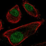 Atlas Antibodies Anti-PRPF31 Antibody
