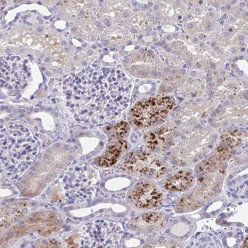 Atlas Antibodies Anti-PRPF38A Antibody