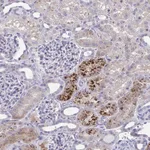 Atlas Antibodies Anti-PRPF38A Antibody