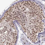 Atlas Antibodies Anti-PRPF39 Antibody