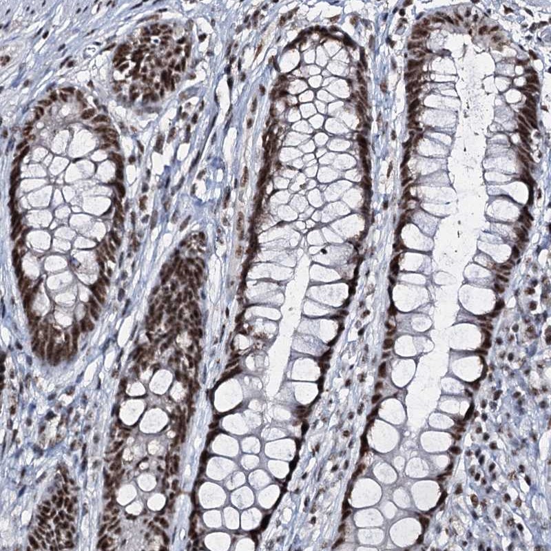 Atlas Antibodies Anti-PRPF40A Antibody