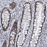 Atlas Antibodies Anti-PRPF40A Antibody