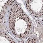 Atlas Antibodies Anti-PRPF40A Antibody