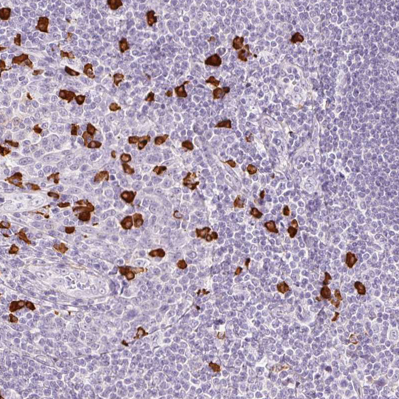 Atlas Antibodies Anti-PRPF38B Antibody