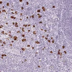 Atlas Antibodies Anti-PRPF38B Antibody