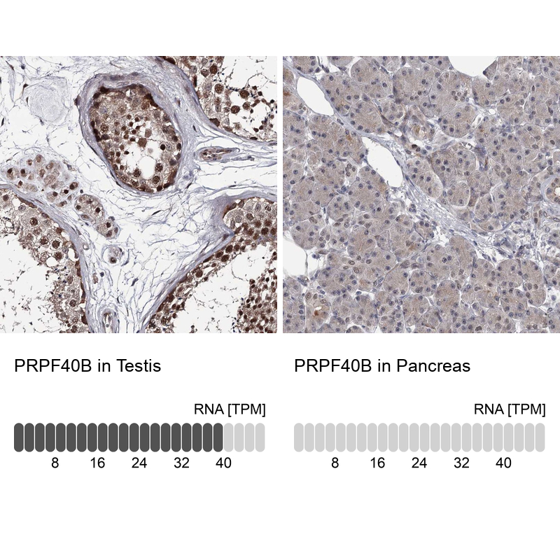 Atlas Antibodies Anti-PRPF40B Antibody