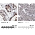 Atlas Antibodies Anti-PRPF40B Antibody