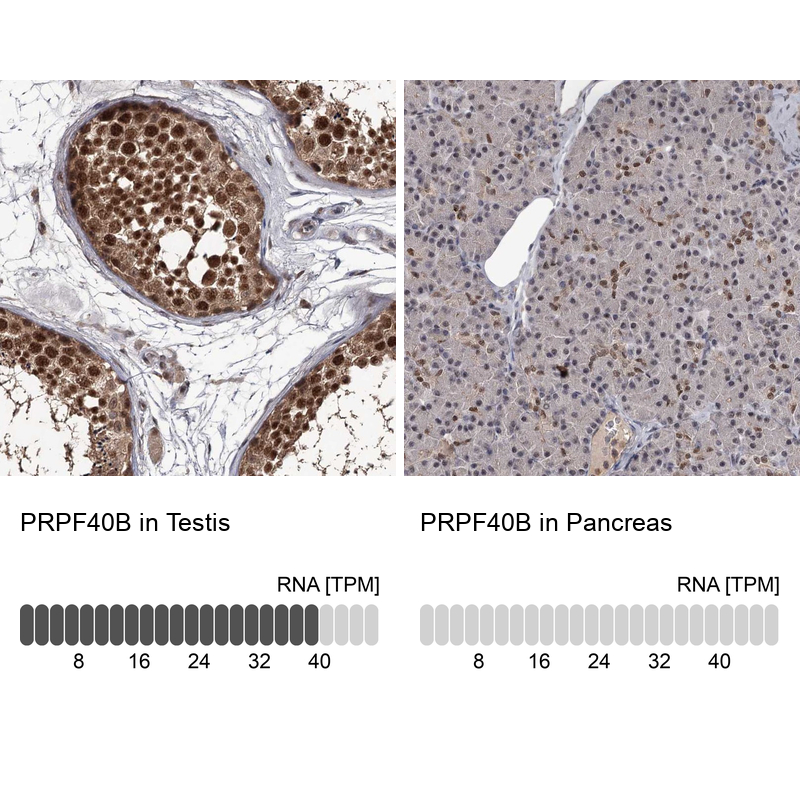 Atlas Antibodies Anti-PRPF40B Antibody