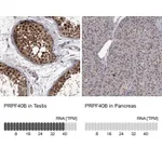 Atlas Antibodies Anti-PRPF40B Antibody