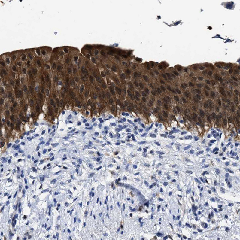 Atlas Antibodies Anti-PRPF4B Antibody