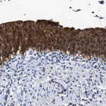 Atlas Antibodies Anti-PRPF4B Antibody