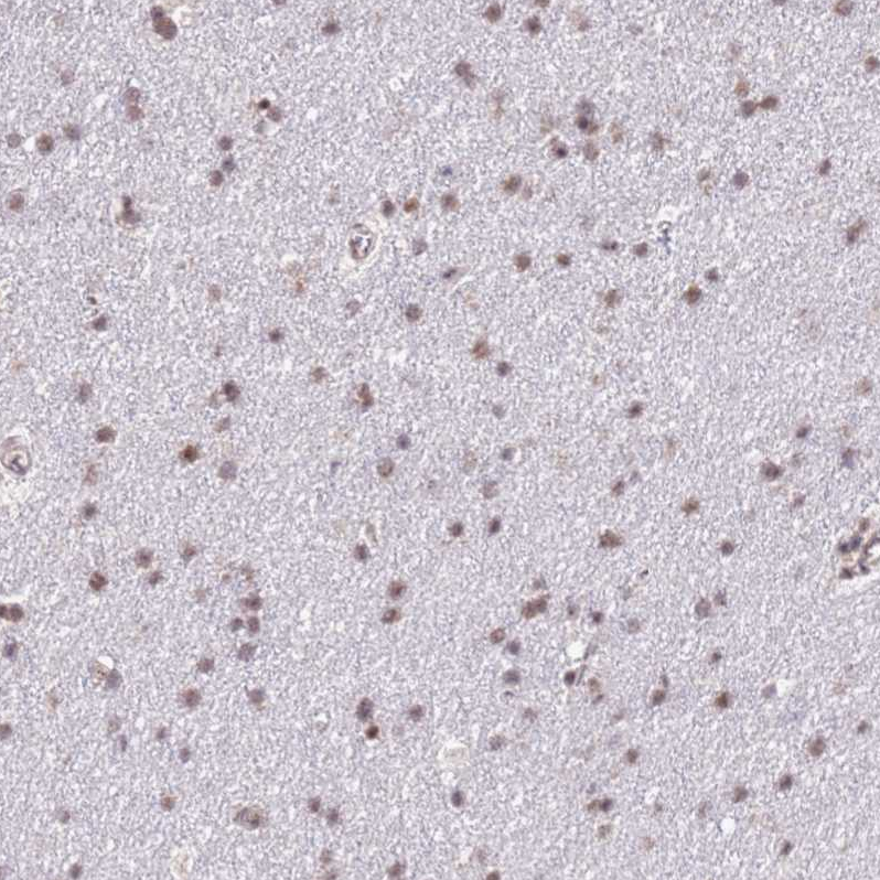 Atlas Antibodies Anti-PRPF6 Antibody